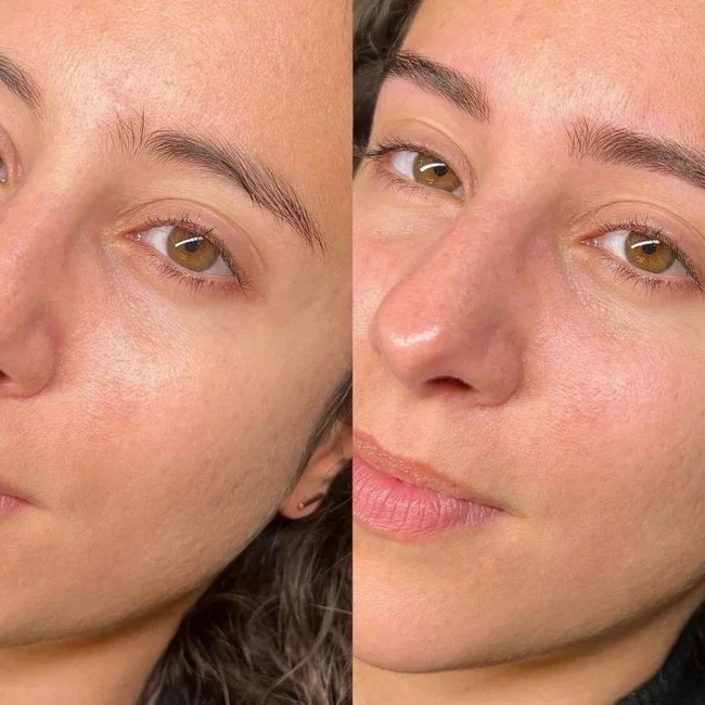 Microblading